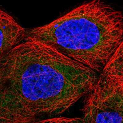 Immunocytochemistry/ Immunofluorescence: TBL2 Antibody [NBP2-55580]