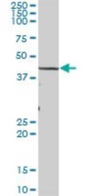 Western Blot: TBL2 Antibody [H00026608-B01P]