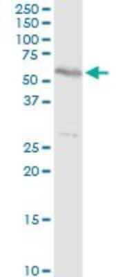 Western Blot: TBL2 Antibody [H00026608-D01P]