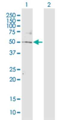 Western Blot: TBL2 Antibody [H00026608-D01P]