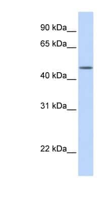 Western Blot: TBL2 Antibody [NBP1-62346]