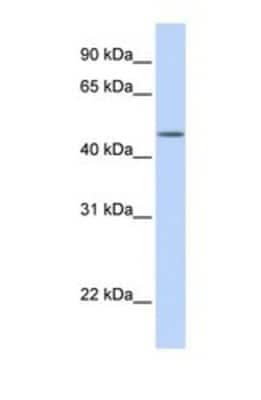 Western Blot: TBL2 Antibody [NBP1-69369]