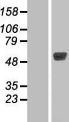 Western Blot: TBL2 Overexpression Lysate [NBP2-07440]