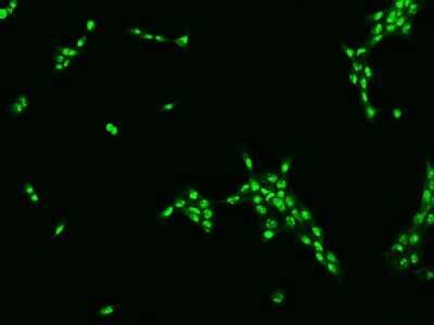 Immunocytochemistry/ Immunofluorescence: TBL3 Antibody [NBP2-97803]