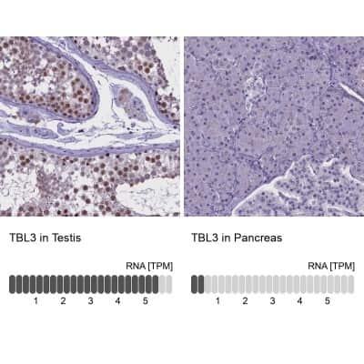 Immunohistochemistry-Paraffin: TBL3 Antibody [NBP1-92481]