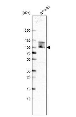 Western Blot: TBL3 Antibody [NBP1-92481]