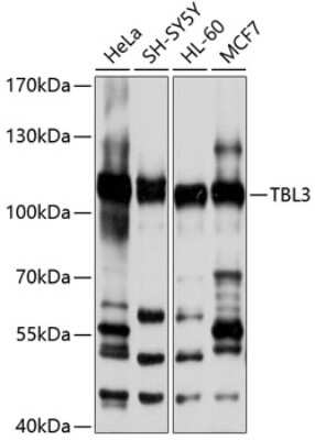 Western Blot: TBL3 AntibodyBSA Free [NBP2-94540]