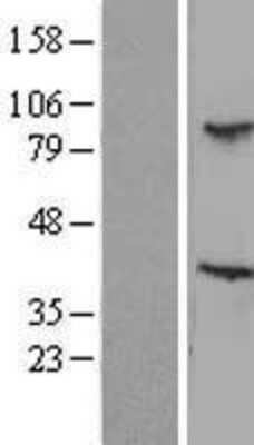 Western Blot: TBL3 Overexpression Lysate [NBL1-16740]