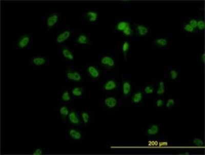 Immunocytochemistry/ Immunofluorescence: TBLR1 Antibody (3G7) [H00079718-M01]