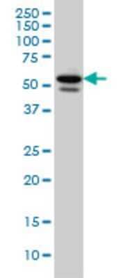 Western Blot: TBLR1 Antibody (3G7) [H00079718-M01]