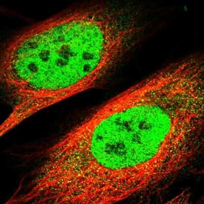 Immunocytochemistry/ Immunofluorescence: TBLR1 Antibody [NBP1-89880]