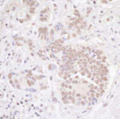 Immunohistochemistry-Paraffin: TBLR1 Antibody [NB600-270]