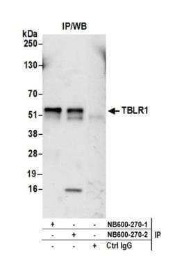 Immunoprecipitation: TBLR1 Antibody [NB600-270]