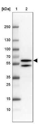 Western Blot: TBLR1 Antibody [NBP1-89880]