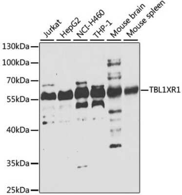 Western Blot: TBLR1 AntibodyBSA Free [NBP2-93697]