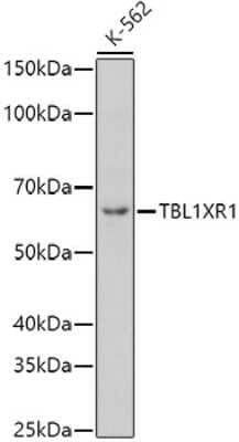 Western Blot: TBLR1 AntibodyAzide and BSA Free [NBP2-94126]