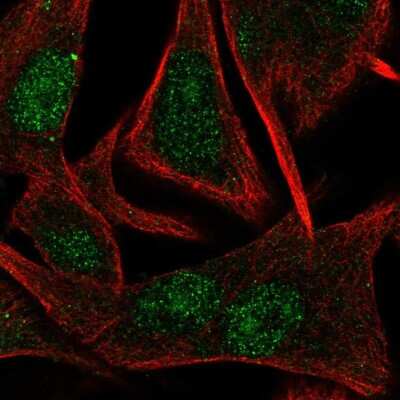 Immunocytochemistry/ Immunofluorescence: TBP like protein TLP Antibody [NBP2-49671]