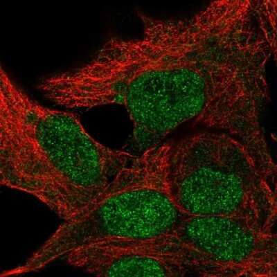 Immunocytochemistry/ Immunofluorescence: TBP like protein TLP Antibody [NBP2-57783]