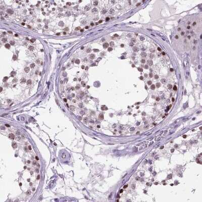 Immunohistochemistry-Paraffin: TBP like protein TLP Antibody [NBP2-49671]