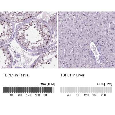 Immunohistochemistry-Paraffin: TBP like protein TLP Antibody [NBP2-49671]