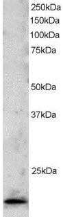 Western Blot: TBP like protein TLP Antibody [NB100-1101]