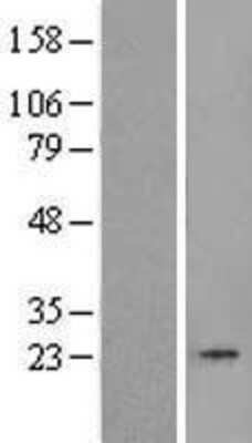 Western Blot: TBP like protein TLP Overexpression Lysate [NBL1-16742]