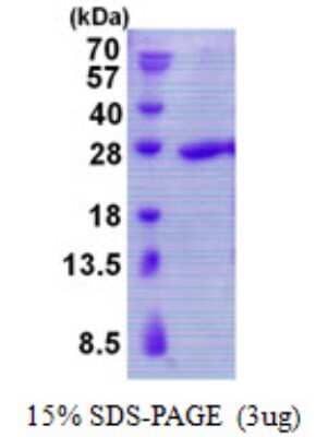 SDS-PAGE: Recombinant Human TBP like protein TLP His Protein [NBP2-22853]