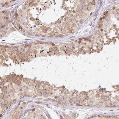 Immunohistochemistry: TBPL2 Antibody [NBP2-49218]