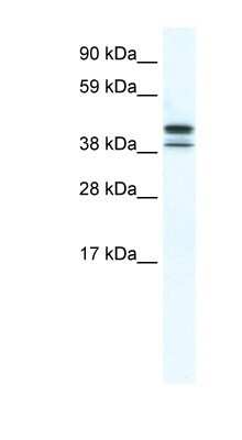 Western Blot: TBPL2 Antibody [NBP1-80268]