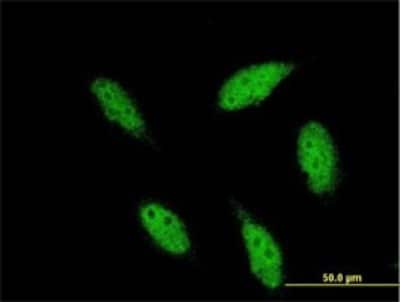 Immunocytochemistry/ Immunofluorescence: TBR1 Antibody (3F6) [H00010716-M01]