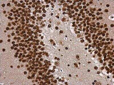 Immunohistochemistry-Paraffin: TBR1 Antibody [NBP2-15133]