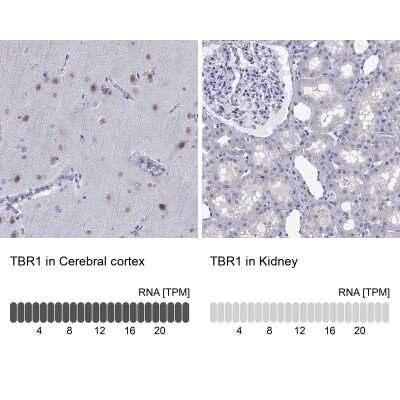 Immunohistochemistry-Paraffin: TBR1 Antibody [NBP2-62728]