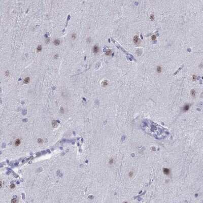 Immunohistochemistry-Paraffin: TBR1 Antibody [NBP2-62728]