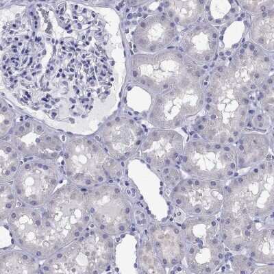 Immunohistochemistry-Paraffin: TBR1 Antibody [NBP2-62728]