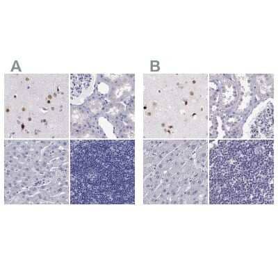 Immunohistochemistry-Paraffin: TBR1 Antibody [NBP2-62728]