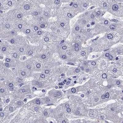Immunohistochemistry-Paraffin: TBR1 Antibody [NBP2-62728]