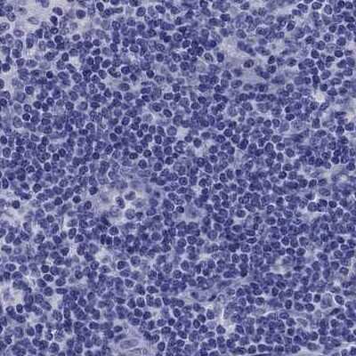 Immunohistochemistry-Paraffin: TBR1 Antibody [NBP2-62728]