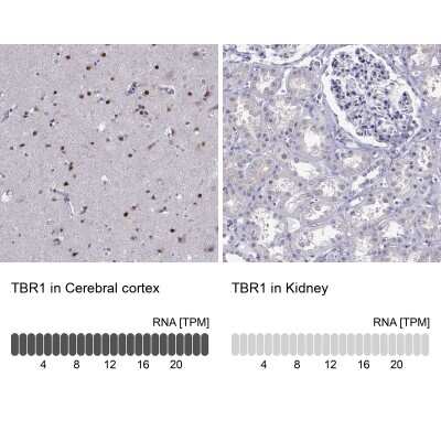 Immunohistochemistry-Paraffin: TBR1 Antibody [NBP2-62729]