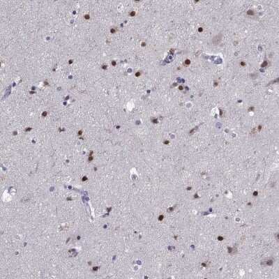 Immunohistochemistry-Paraffin: TBR1 Antibody [NBP2-62729]