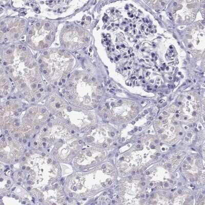 Immunohistochemistry-Paraffin: TBR1 Antibody [NBP2-62729]
