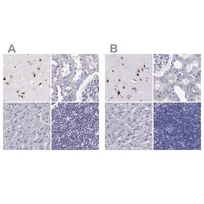 Immunohistochemistry-Paraffin: TBR1 Antibody [NBP2-62729]