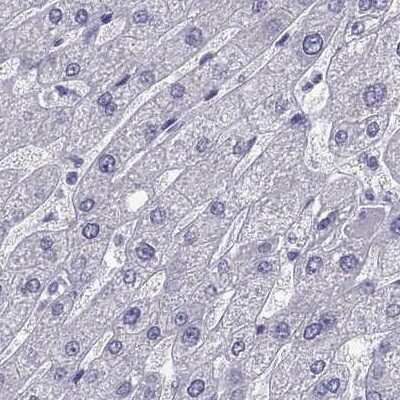 Immunohistochemistry-Paraffin: TBR1 Antibody [NBP2-62729]