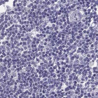 Immunohistochemistry-Paraffin: TBR1 Antibody [NBP2-62729]