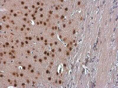 Immunohistochemistry-Paraffin: TBR1 Antibody [NBP3-13178]