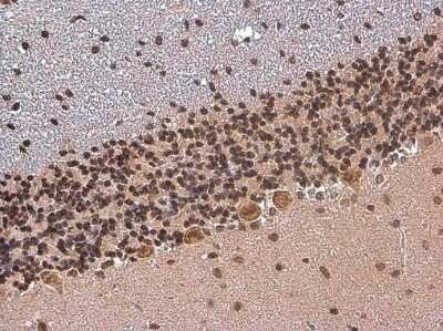 Immunohistochemistry-Paraffin: TBR1 Antibody [NBP3-13178]