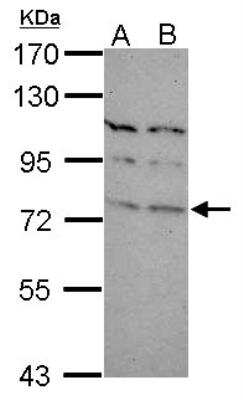 Western Blot: TBR1 Antibody [NBP2-15133]