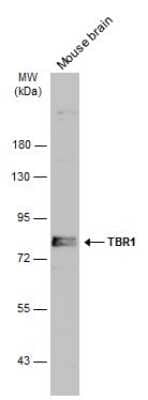 Western Blot: TBR1 Antibody [NBP3-13178]