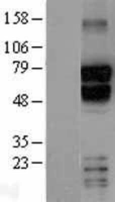 Western Blot: TBR1 Overexpression Lysate [NBL1-16743]