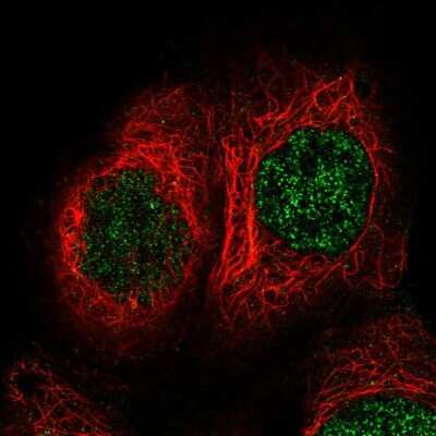 Immunocytochemistry/ Immunofluorescence: TBRG1 Antibody [NBP2-55805]