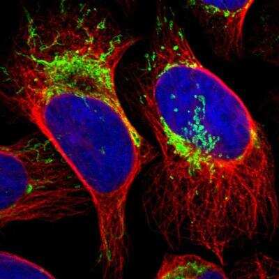 Immunocytochemistry/ Immunofluorescence: TBRG4 Antibody [NBP1-85478]